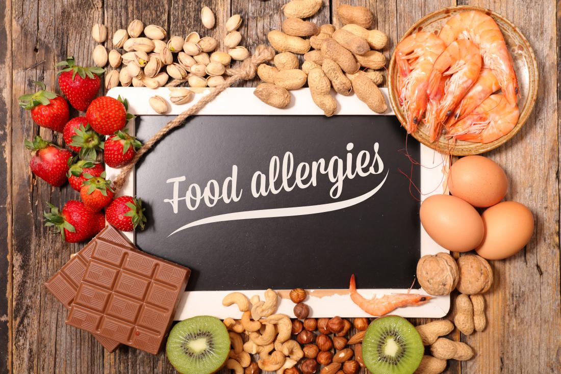 Food-Allergies